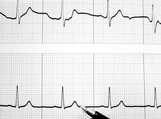 Chartbeat进行了重新设计 着重于参与度 从而超越了页面浏览量