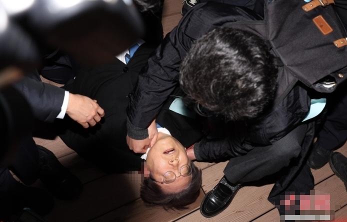 韩国共同民主党党首遭袭事件：专业医学观点解析李在明颈静脉受损可能原因及处理